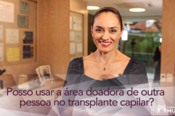 Posso usar fios de cabelo de outra pessoa no transplante capilar?