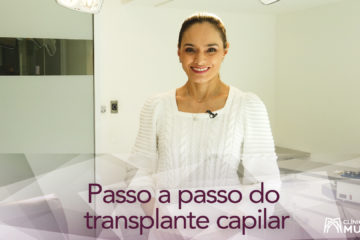 O transplante capilar é uma cirurgia longa, então é importante saber como é o passo a passo desse procedimento.