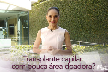 Pessoas com pouco cabelo na área doadora podem fazer transplante capilar? Existem alternativas?