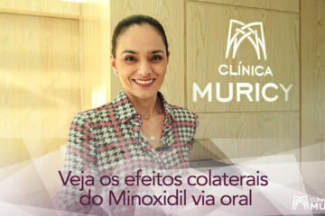 O Minoxidil via oral é um tratamento eficaz contra a queda de cabelo, mas exige cuidados.