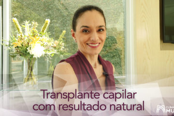Como obter um resultado natural no transplante capilar?