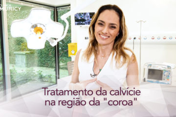 A calvície na região da coroa pode ser tratada. Saiba como é a técnica empregada.