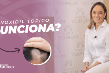 O que fazer quando o Minoxidil tópico não funciona?