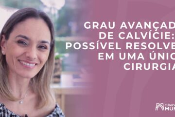 É possível resolver uma calvície extensa com uma única cirurgia?