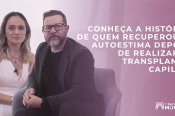 Conheça o depoimento de quem realizou o transplante capilar