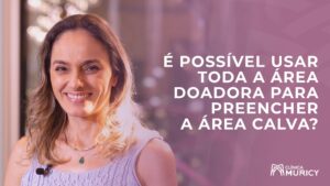 É possível usar toda a área doadora no transplante capilar?