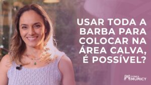 É possível usar toda a barba na área calva?
