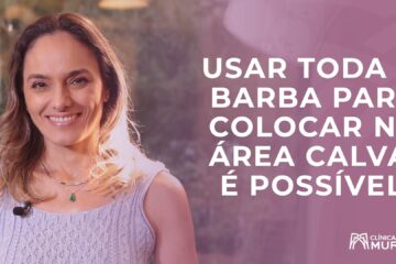 É possível usar toda a barba na área calva?