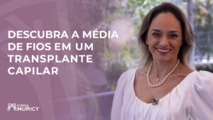 Quantos fios são transplantados na técnica FUE?
